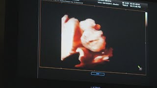 THE CUTEST BABY IN FANGS BELLY! HE IS SMILING! NEW 4d scan uncut.