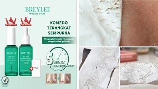 Masker Untuk Mengangkat Komedo dan Mengecilkan Pori-Pori Kulit Wajah