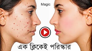 How To skin clear , Smooth Skin and Remove Blemishes, acne and pimple make skin smooth