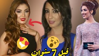 #سهيلة_بن_لشهب🔥 قبل وبعد عملية التجميل 😍طلقة روسية 😯#souhilabenlachhab