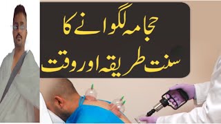 Hijama Lagwane Ka Sunnat Tariqa Aur Waqt history in Islam | Solve Your Problems | Hajama Ki Fazilat