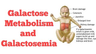 Galactose metabolism || #Biochemistry