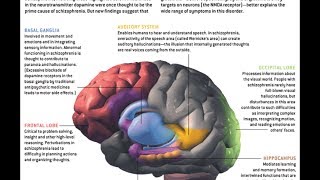 Schizophrenia