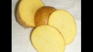 Potato for dark circles under eyes - Simple home remedy for dark circles under eyes