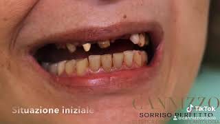 Impianti dentali