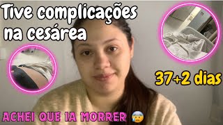 MEU RELATO DE PARTO CESÁREA PELO SUS | 37 SEMANAS + 2 DIAS | PRÉ-ECLÂMPSIA