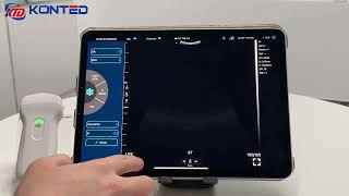 Demo how to use Konted "MY USG" Wifi ultrasound APP