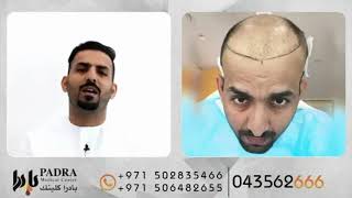 Hair Transplant