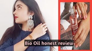 Bio Oil Honest Review In Hindi // Stretch Marks // Chanchal kanwar