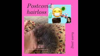 #postcovidhairloss#covid 19# excessive hair loss  cure & treatment