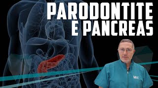 Correlazione tra parodontite e carcinoma del Pancreas