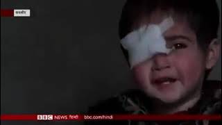 Hiba Nisar - The Youngest Pellet Victim of Jammu and Kashmir