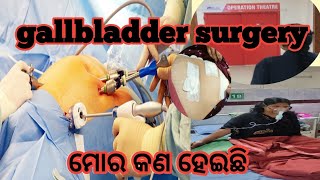 How to gallbladder stone surgery କେମିତି ହେଲା।।#gallbladder#surgery#natureslovesuchitralenka.