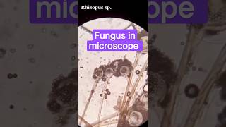 Fungus in microscope #fungus #fungusinfection #labstatus #viralvideos #labtech #hematology