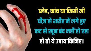 ब्लेड, कांच या किसी भी चीज़ से शरीर में लगे हुए कट से खून बंद नहीं हो रहा हो तो ये उपाय किजिए।