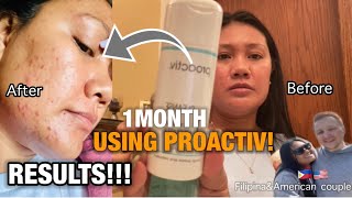 PROACTIV HONEST REVIEW|MAY Axe SA ROOM NI BYANAN KO #filipinamarriedtoforeigner #ACNE #Proactiv