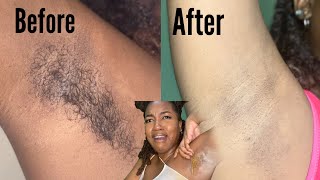 I TRIED SUGAR WAXING MY ARMPITS AT HOME(FAIL?)|LIGHTEN UNDERARMS WITH SUGARING? |HOW TO DIY SUGARING