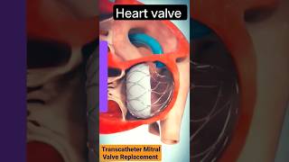 heart Volvo #hearttouchingstory #physiotherapy #medicalanimation #chiropractic #medicalstudent