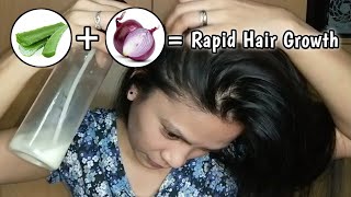 Amazing Aloe Vera and Onion Juice for rapid hair growth