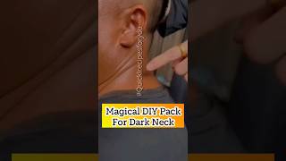 Remove neck darkness in 10 mins😱💯 #shorts #beautytips #skincare #viral #homeremedies #youtube