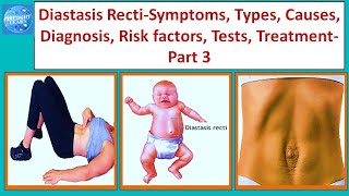 Diastasis Recti Symptoms, Types, Causes, Diagnosis, Risk factors, Tests, Treatment Part 3