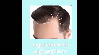 Earlier signs of male pattern baldness/வழுக்கை வருவதை எப்படி கண்டுபிடிப்பது?