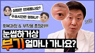 눈썹하거상술 후 가장 많이 하는 질문! 싹~다 대답해드립니다 (흉터, 부기, 통증, 부작용, 회복기간, 관리방법) - 의학박사 백승준