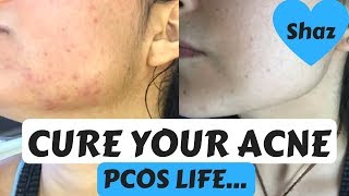 Curing Hormonal Acne | PCOS | 3 Diet Changes + Organic Meat Shopping