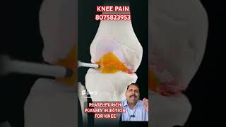 PRP FOR KNEE