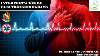 CURSO VIRTUAL DE INTERPRETACIÓN DE ELECTROCARDIOGRAMA EN EMERGENCIA