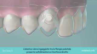 SMILETECH   Smiletech Elastico Estrusore ITA