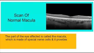 Retina Specialist - Mr Mahi Muqit PhD FRCOphth