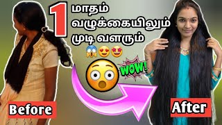 😍Baldness hair regrowth gel||புதிய  முடி அடர்த்தியாக வளரும்❤️Magical hair gel 😍