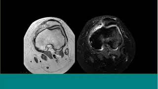 MSK MRI CASE STUDIES