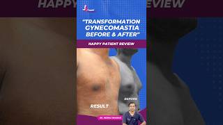 Watch as our satisfied patient shares their joy after undergoing gynecomastia surgery!