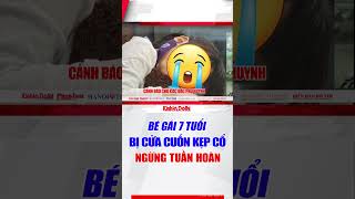 Bé gái 7 tuổi bị cửa cuốn kẹp cổ, ngừng tuần hoàn