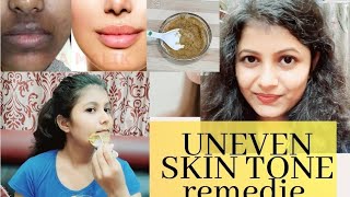 HOME REMEDIES FOR UNEVEN SKIN TONE | মুখের কালো ছোপ দূর করার ফেসপ্যাক ।