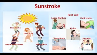 Sunstroke|Incredible Unknown Facts About Sunstroke| Everything You Need to Know About Sunstroke