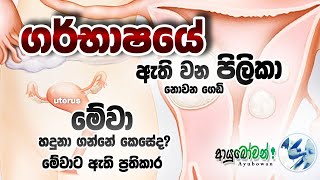 ගර්භාෂයේ ඇති වන පිලිකා නොවන ගෙඩි| Fibroid |මේවා හදුනා ගන්නේ කෙසේද | මේවාට ඇති ප්‍රතිකාර|ආයුබෝවන්