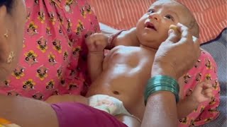 नवजात शिशु और बच्चों के शरीर के अनचाहे बाल कैसे हटाएँ | How to remove baby's body Hair