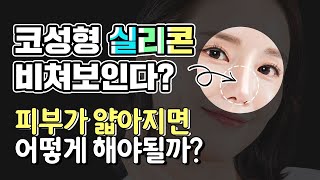 코성형 후 실리콘 비침 왔을때 어떻게 해야 될까?