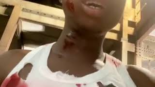 zlatan ibile beaten up in Uganda