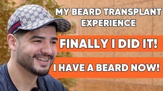 My Expedience With Beard Transplant | Sufian After 5 MONTHS OF BEARD TRANSPLANT!