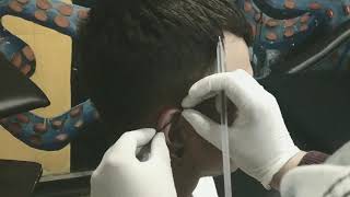 The day I got INDUSTRIAL PIERCING | new type of piercing|