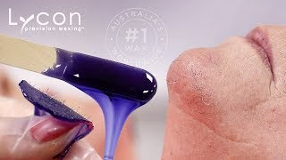 Goodbye Pesky Chin Hairs With LYCOJET Lavender Hot Wax | LYCON Cosmetics