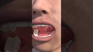 Tonsils 3d animation video Human body #shorts