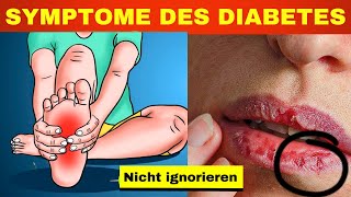 Die 5 wichtigsten Symptome von Diabetes die niemand kennt