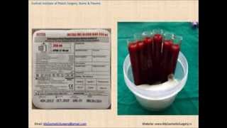 Preparation of Platelet Rich Plasma PRP inside the OT Setup video