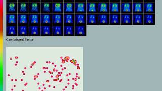 Gammagrama renal