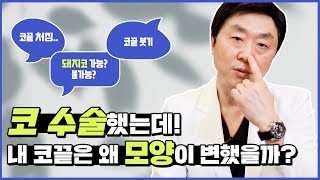 코끝수술 부작용! 코끝처짐, 변형, 휨은 왜 생길까요? (코수술후 붓기, 돼지코 등 코끝성형 전 시청 필수!) - 의학박사 백승준